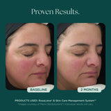 Marini Skin Solutions RosaLieve 30ml