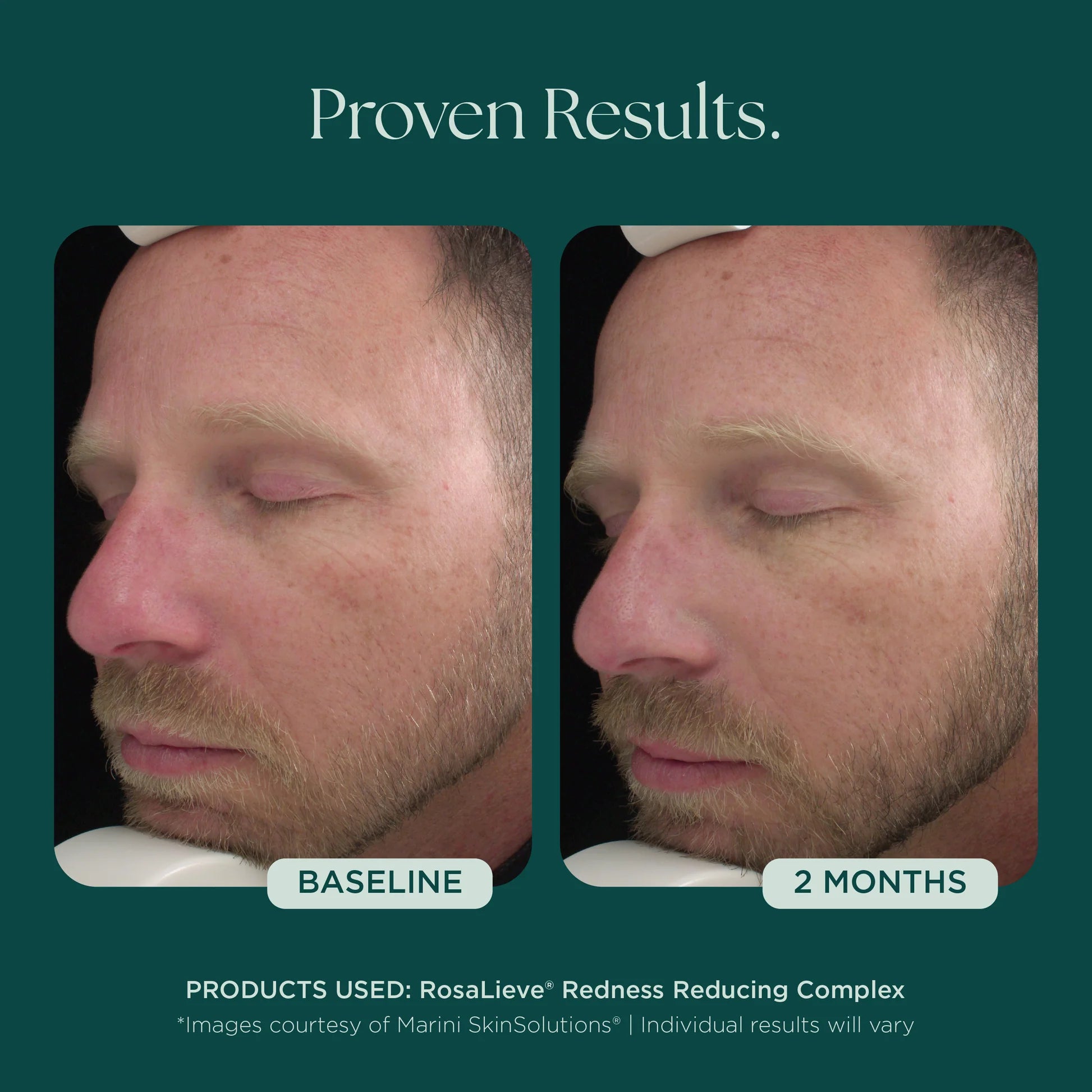 Marini Skin Solutions RosaLieve 30ml