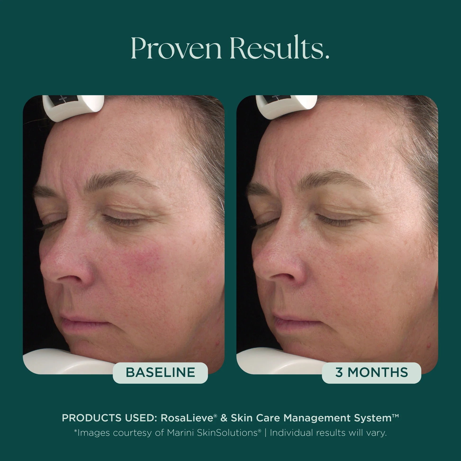 Marini Skin Solutions RosaLieve 30ml