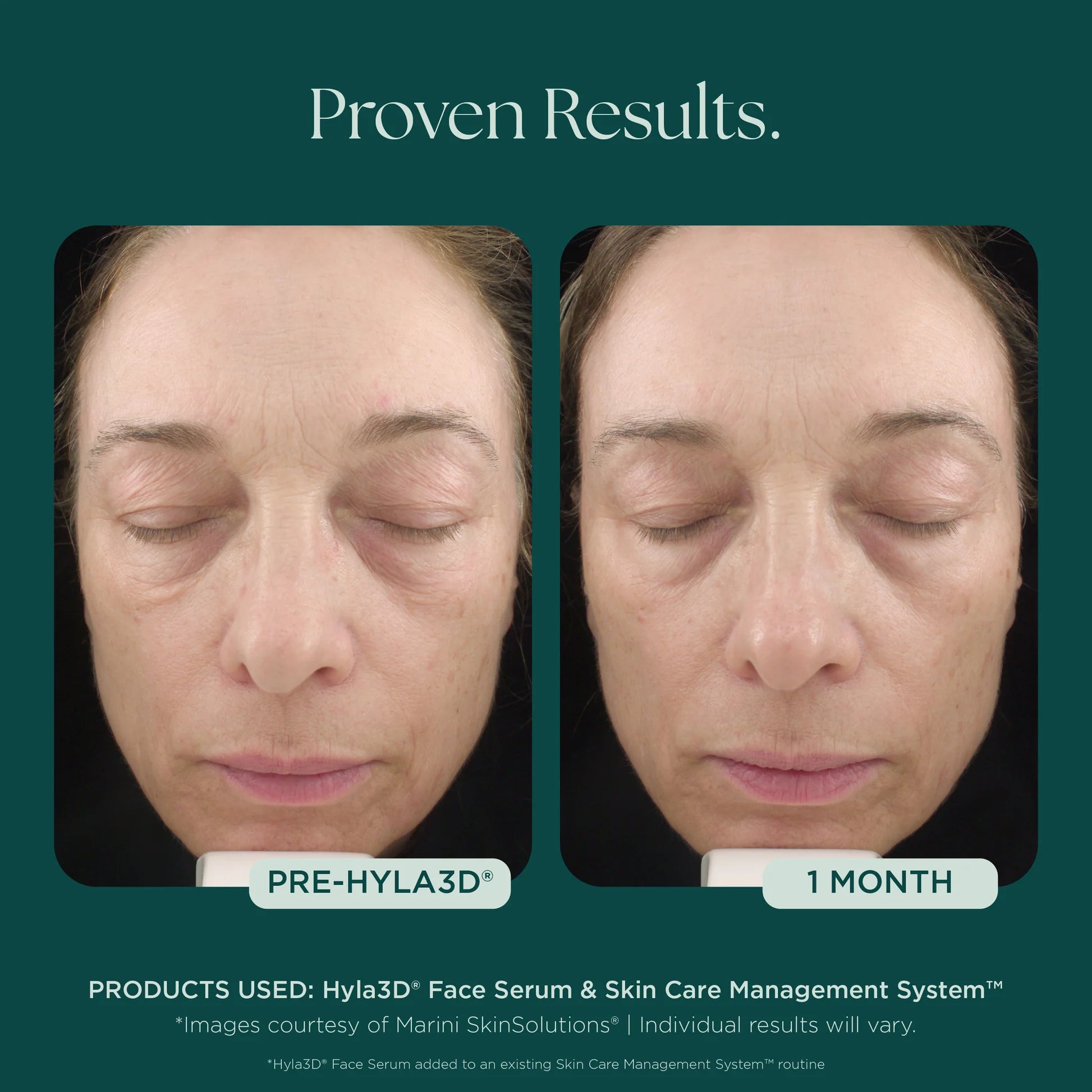 Marini Skin Solutions Hyla3D Face Serum 30ml