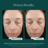 Marini Skin Solutions Hyla3D Face Serum 30ml