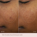 MZ Skin Micro-Peeling Glow Essence 100ml
