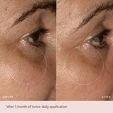 MZ Skin Soothe & Smooth Hyaluronic Brightening Eye Complex 14ml