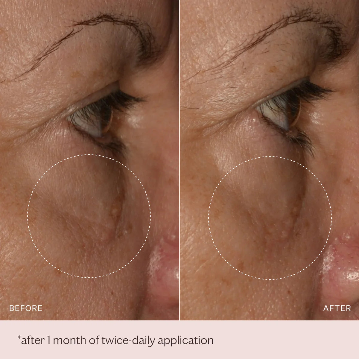 MZ Skin Soothe & Smooth Hyaluronic Brightening Eye Complex 14ml