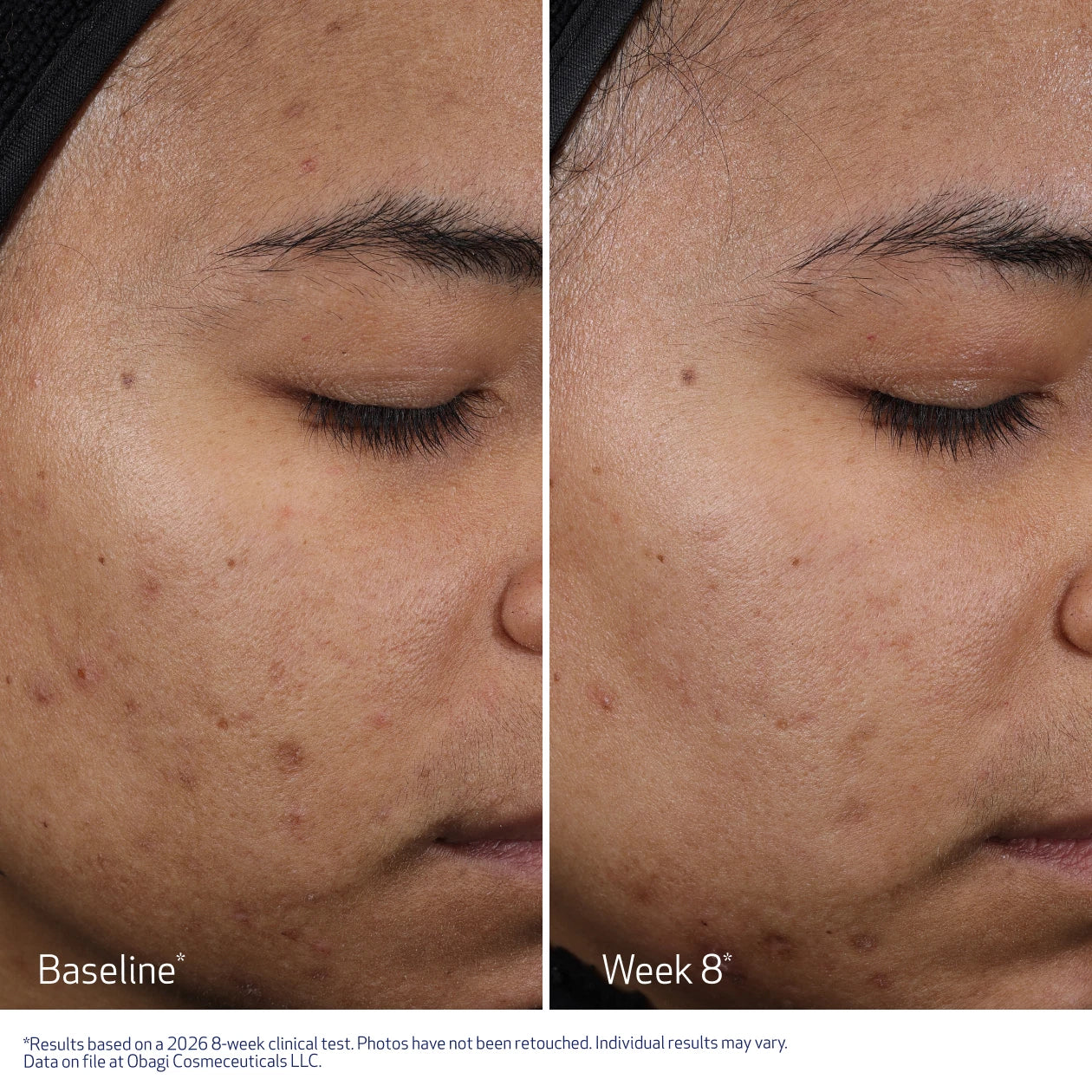 Obagi CLENZIderm M.D. Resurfacing Multi-Acid Peel Pads (30 Pads)