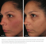 Ormedic Balancing Antioxidant Serum 30ml