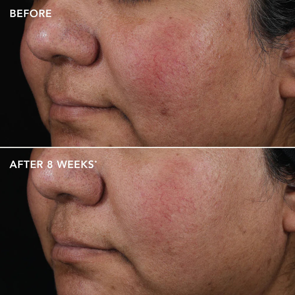 Ageless+ Retinol Pure Liquid Retinol 0.75% 30ml