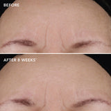 Ageless+ Retinol Treatment Crème 1.2% Retinol Complex 28.5g