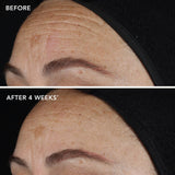 Ageless+ Retinol Pure Liquid Retinol 0.1% 30ml