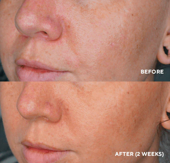 LumaPro C 30ml