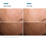 SkinCeuticals Discoloration Defense Serum 30ml