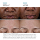 SkinCeuticals Cell Cycle Catalyst 30ml