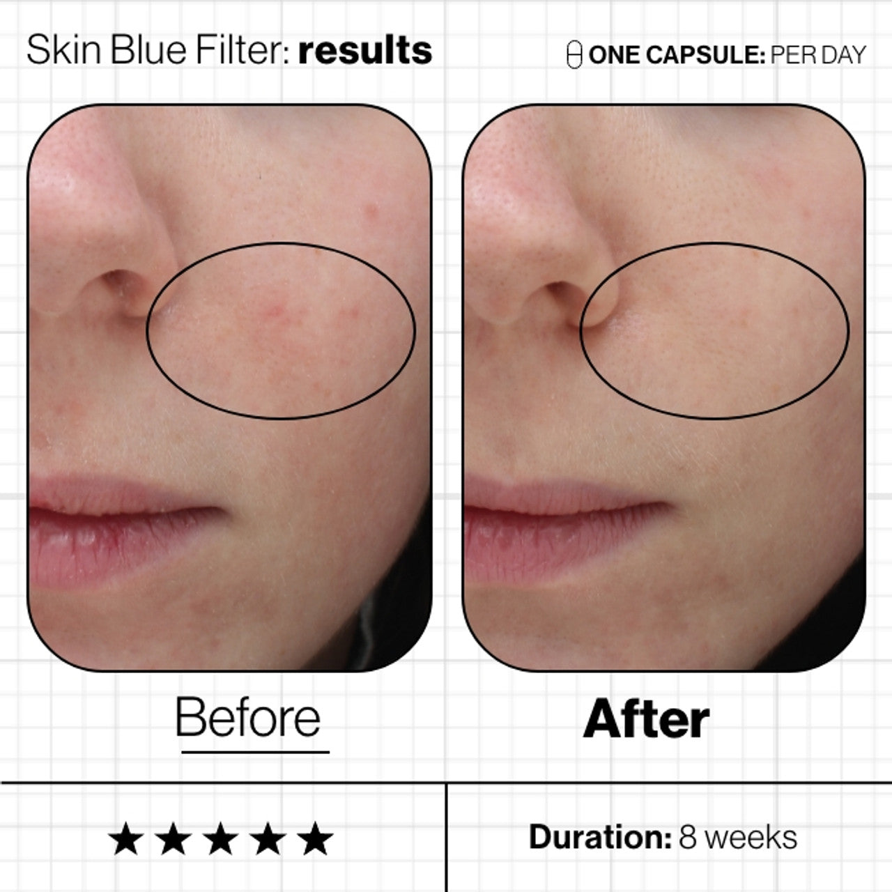 Skin Blue Filter - Shields Skin From Blue Light