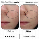 Skin Blue Filter - Shields Skin From Blue Light