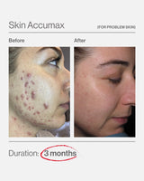 Skin Accumax - Targets Problem Skin