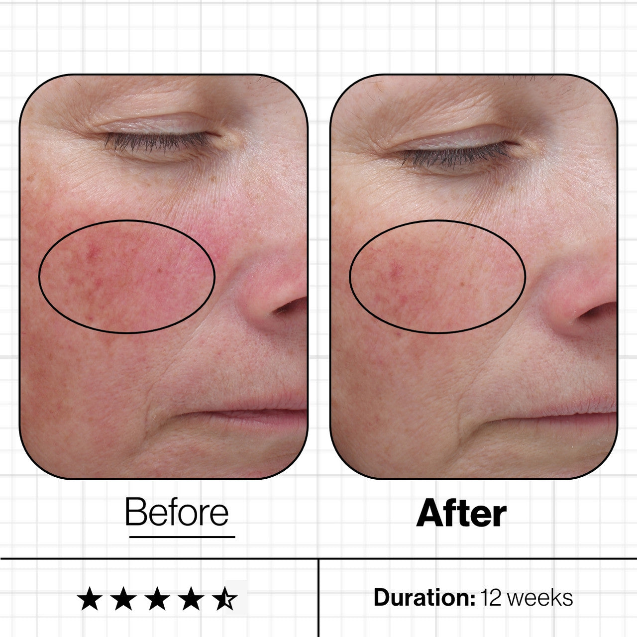 Skin Even IQ - Targets Stubborn Pigmentation