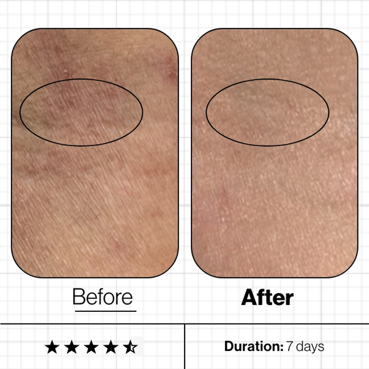 Skin Moisture IQ - Targets Dry Skin