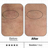 Skin Moisture IQ - Targets Dry Skin
