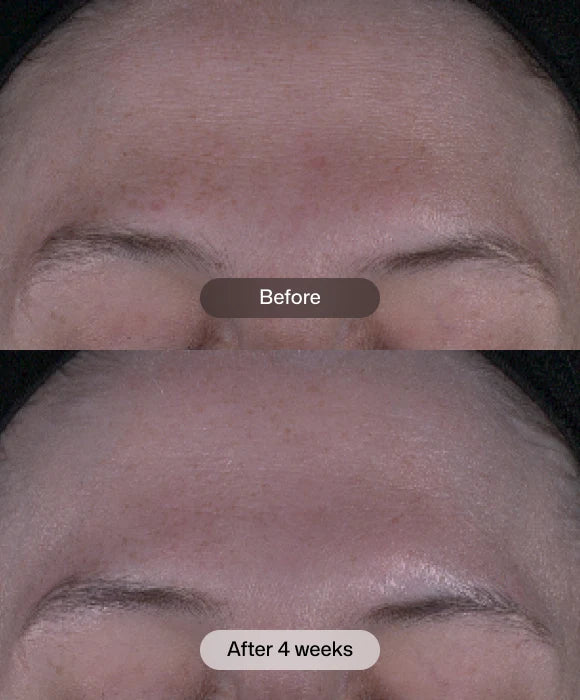 Revision Skincare Tone+ Correcting Pads™ - 30 Pads