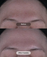 Revision Skincare Tone+ Correcting Pads™ - 30 Pads