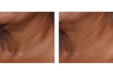 Techno Neck Perfecting Cream 50ml