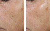 Trio Rebalancing Moisture Treatment 50ml