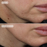 VOL.U.LIFT™ GLP-1 4D Skin Rebound Complex 57g