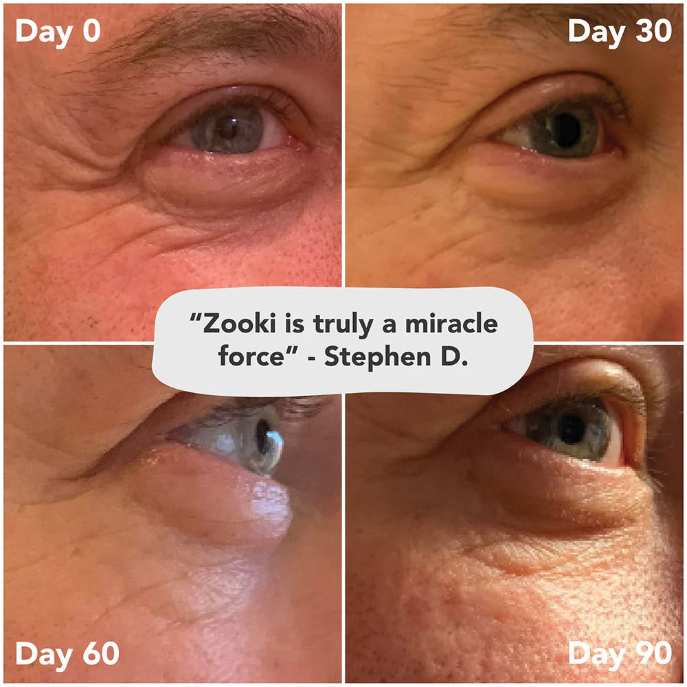 Zooki Super Strength Collagen Sour Cherry Liquid Sachets