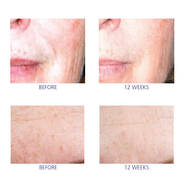 iS CLINICAL Active Serum