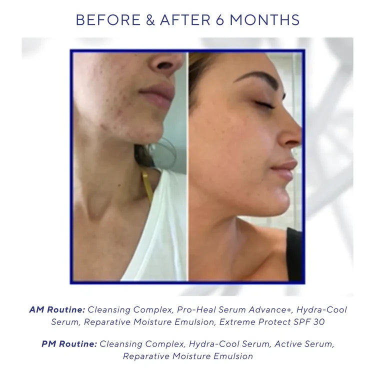 iS CLINICAL Active Serum