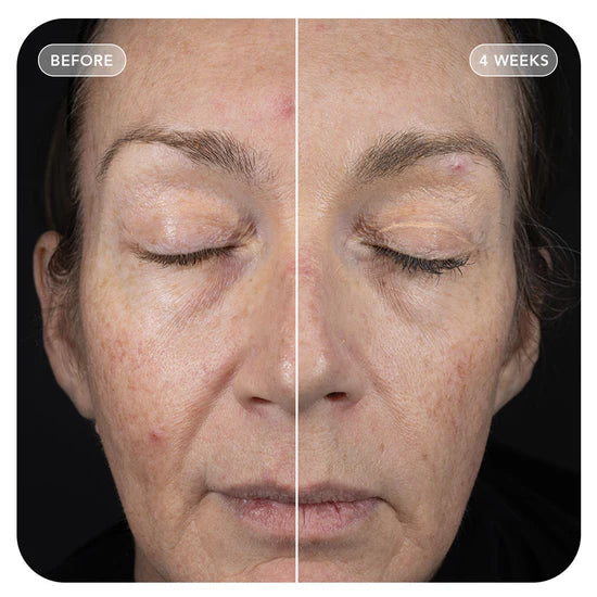 VOL.U.LIFT™ GLP-1 4D Skin Rebound Complex 57g