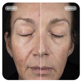 VOL.U.LIFT™ GLP-1 4D Skin Rebound Complex 57g