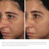 Ormedic Balancing Biopeptide Crème 57g