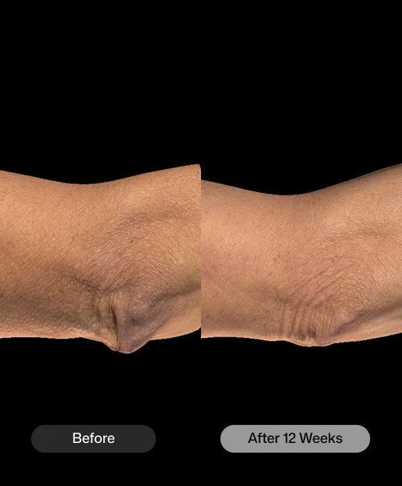 Revision Skincare BodiContour™ 107g