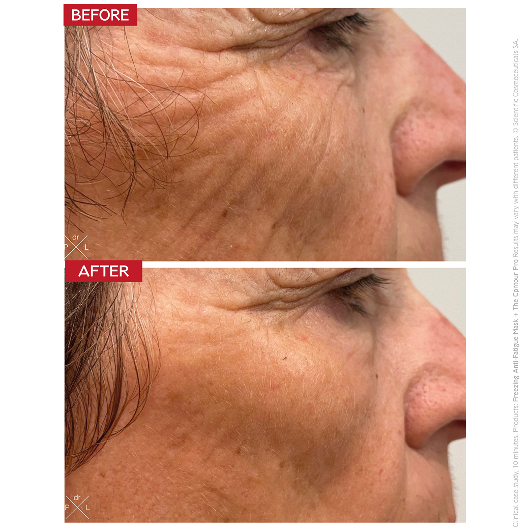 Dr LEVY Contour Pro