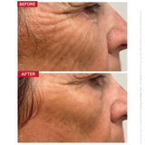 Dr LEVY Contour Pro