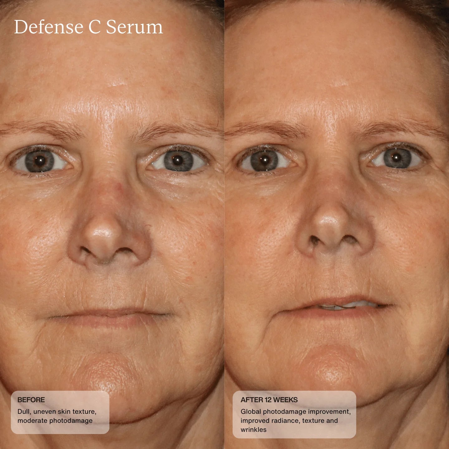 Senté Defense C Serum 30ml