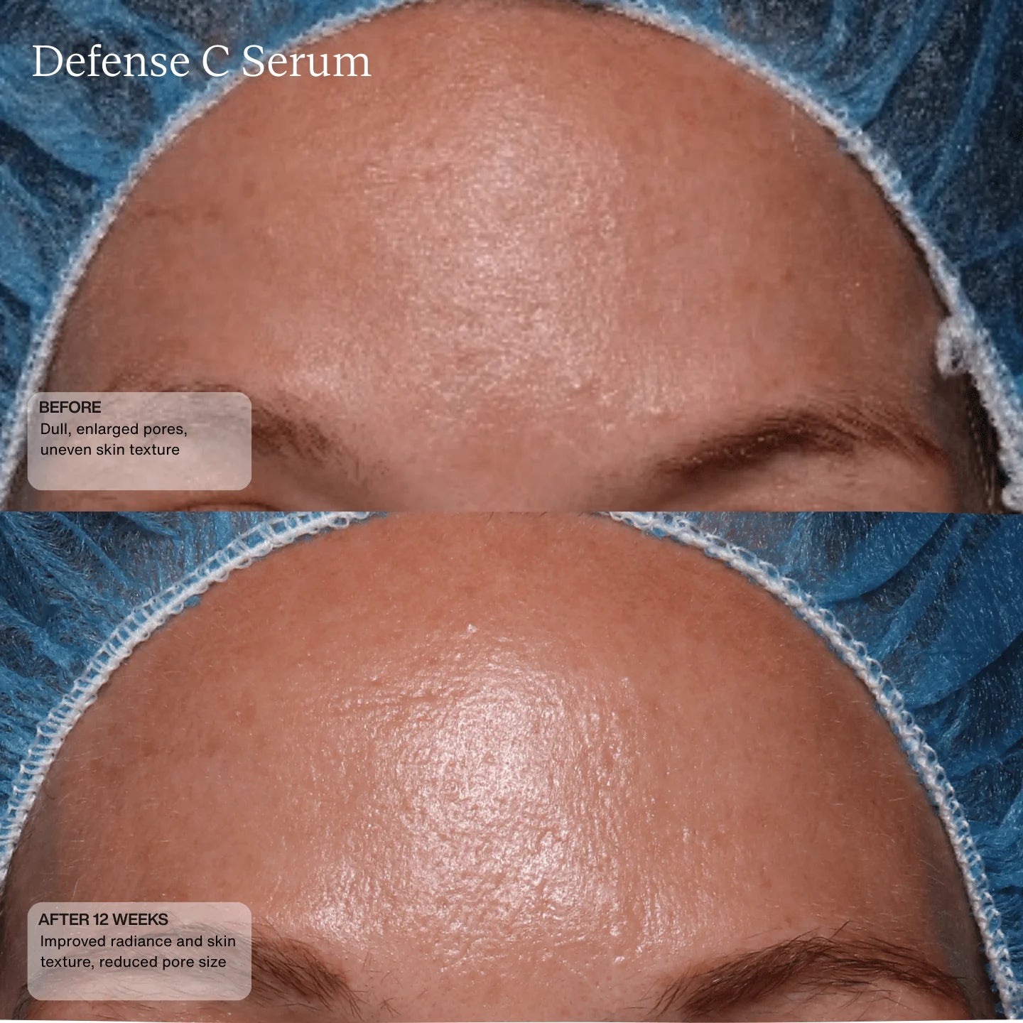 Senté Defense C Serum 30ml