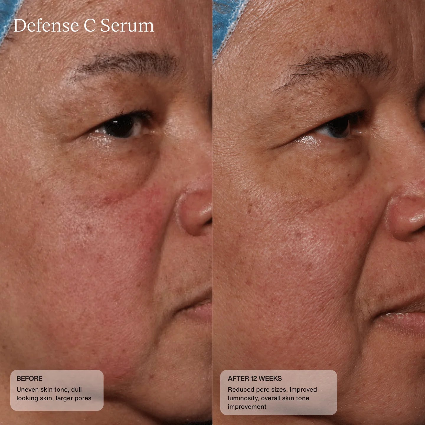 Senté Defense C Serum 30ml