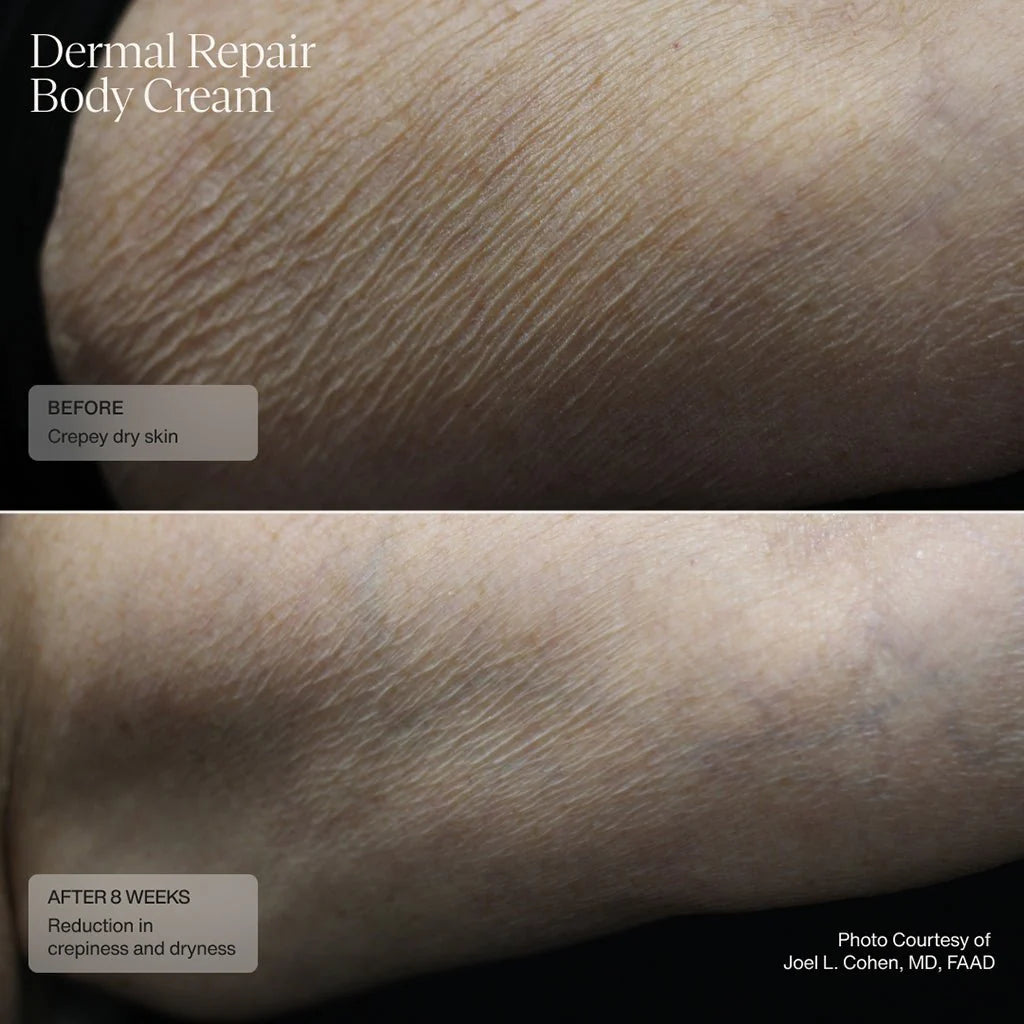 Senté Dermal Repair Body Cream 177.4ml