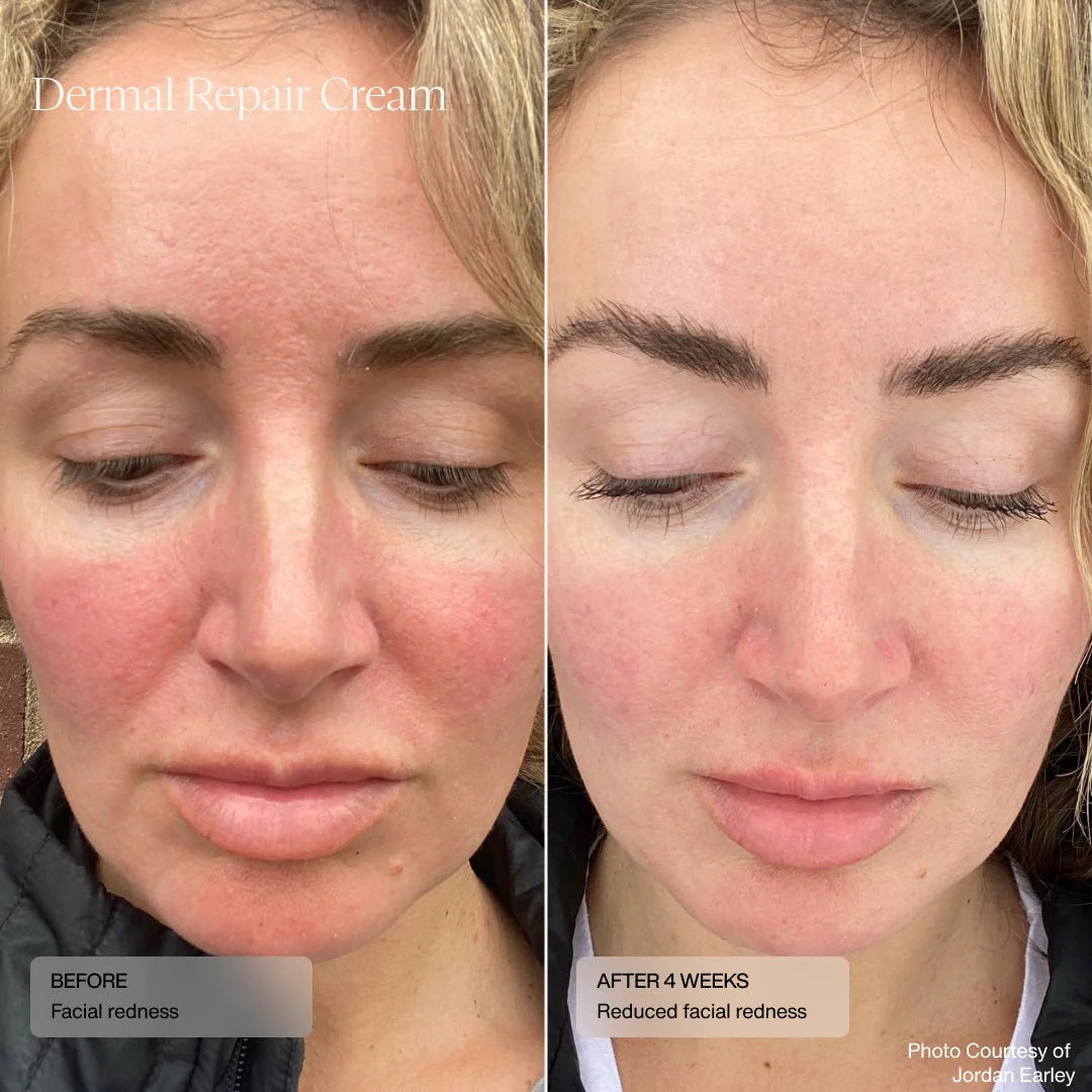 Dermal Repair Cream - 50mls