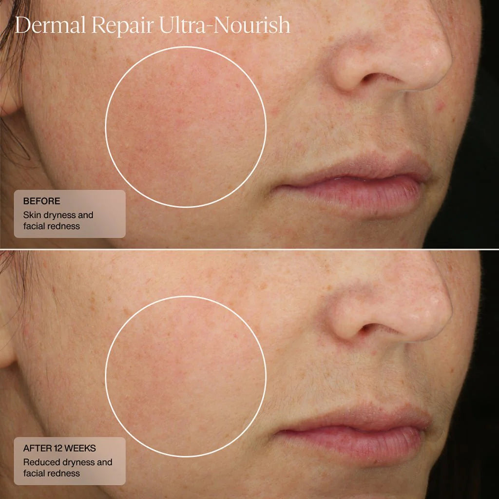 Dermal Repair Ultra Nourish Cream - 50mls