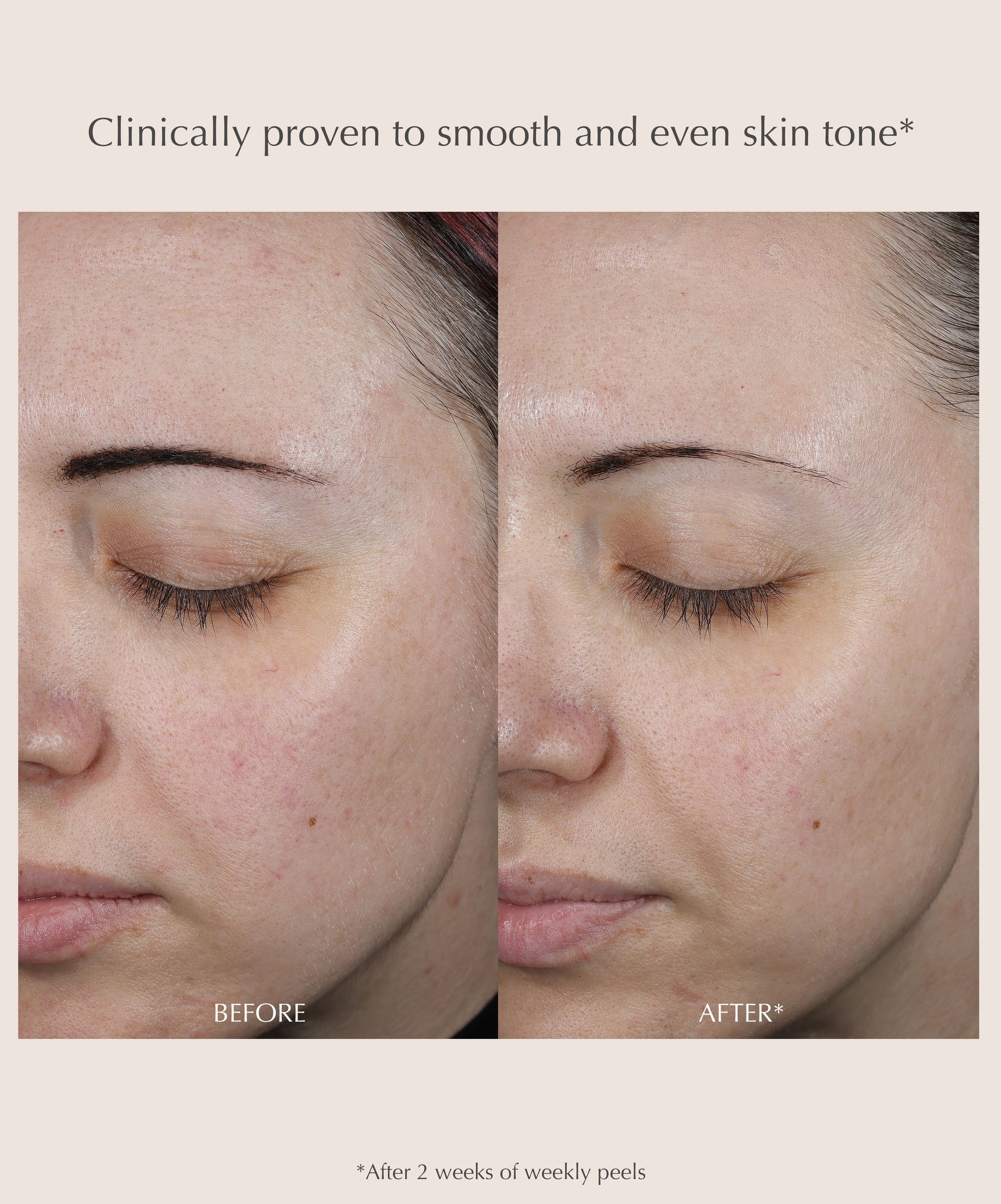 Exuviance Performance Peel AP25 At-Home Chemical Peel