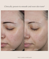 Exuviance Performance Peel AP25 At-Home Chemical Peel