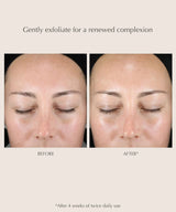 Exuviance Gentle Daily Exfoliating Pads, 60 pads