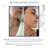 iS CLINICAL Hydra-Cool Serum