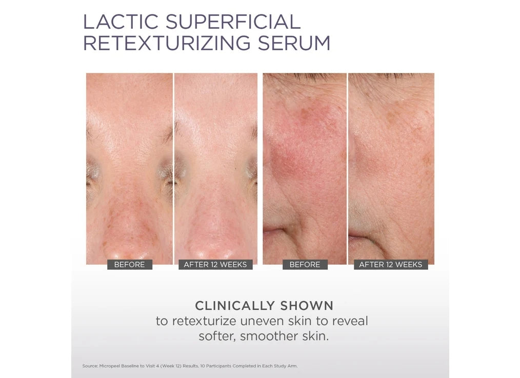 Glytone Lactic Superficial Retexturizes Serum 30ml