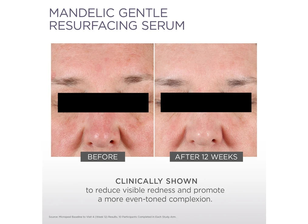 Glytone Mandelic Gentle Resurfacing Serum 30ml