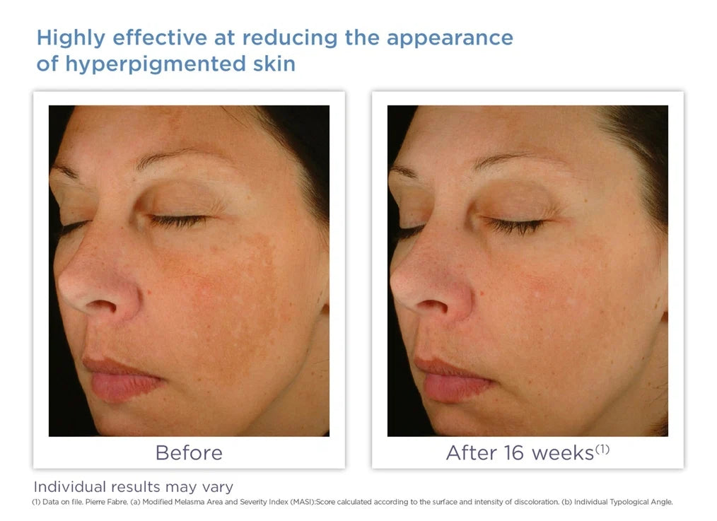 Glytone Enhance Brightening Complex 30ml