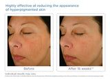 Glytone Enhance Brightening Complex 30ml